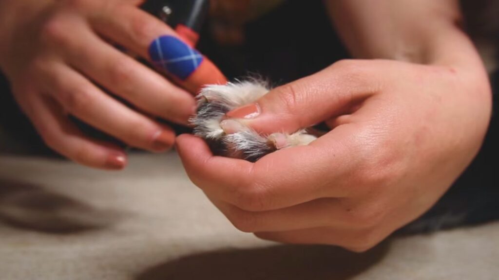 Frequency of Nail Trimming